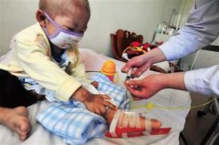 “白血病”兒童增加,甲醛危害值得關注