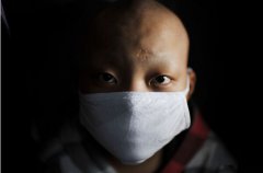 裝修除甲醛,預防白血病的其中一條途徑